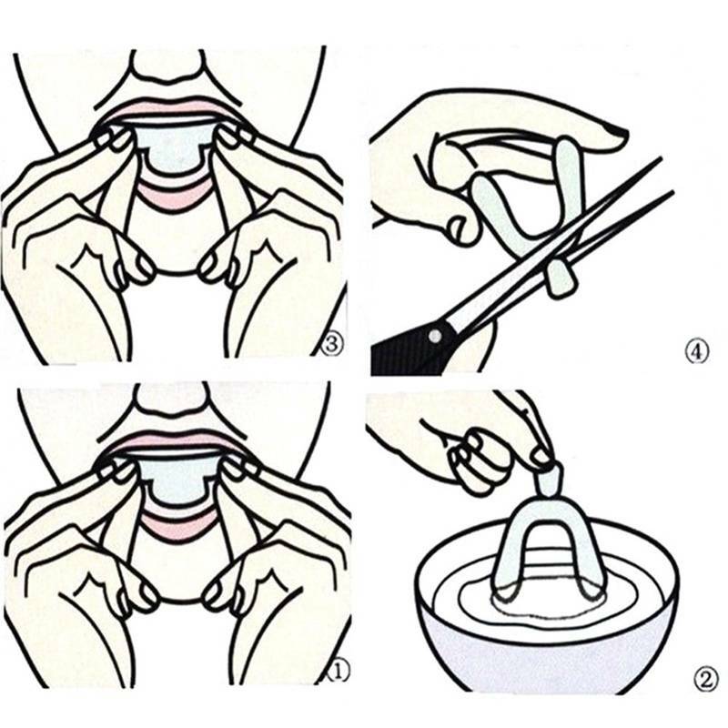 4X Silicone Night Mouth Guard Teeth Clenching Grinding ...