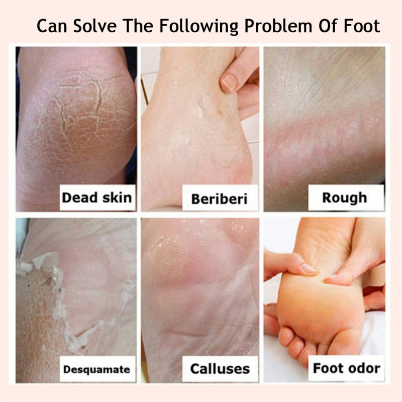 Horse Oil Foot Cream, Instantly Hydrates & Moisturizes Cracked or Callused Feet,