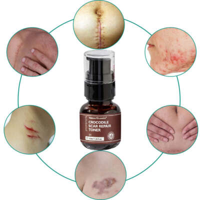Moisturizing Scar Repair Skin Toner Smoothing Acne Repair Crocodile Serum 40ml