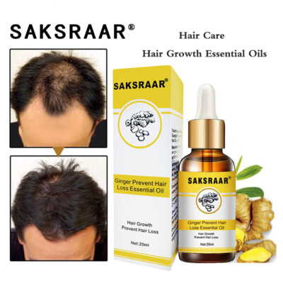 Saksraar Ginger Prevent Hair Loss Essential Oil , Hair Growth Essential Oil