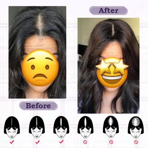 Free Part Lace Clip in Top REAL Human Hair Topper Toupee Piece Women Hairpiece A