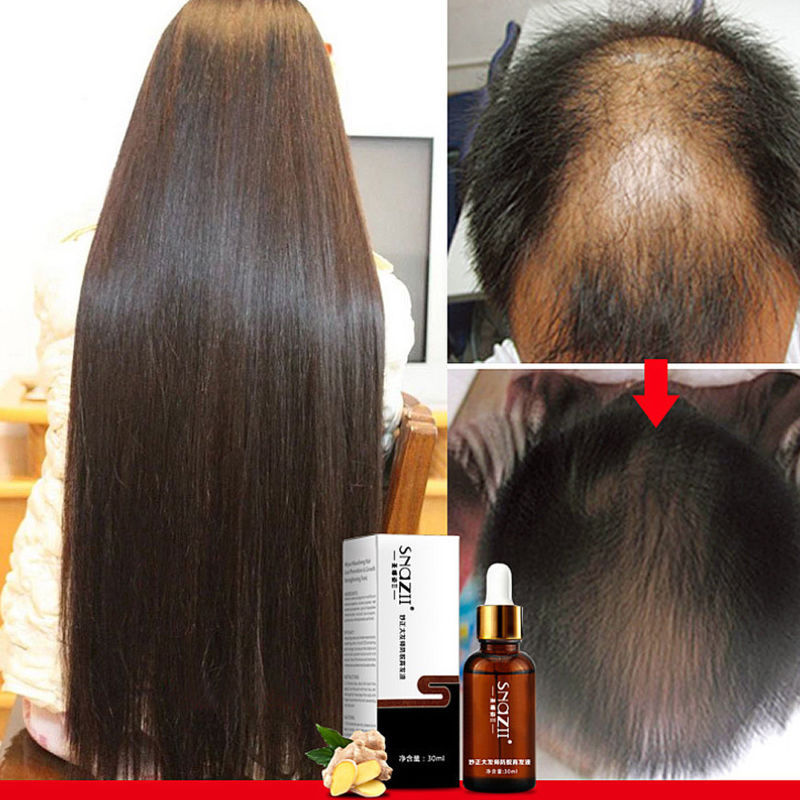 Organic Hair Growth Essence Loss Oil Treatment Fast Natural Liquid