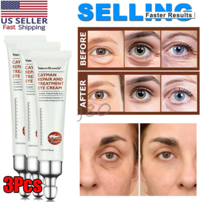 3-Pack Magic Eye Cream Firming Anti Puffiness Aging Wrinkles Remove Dark Circles