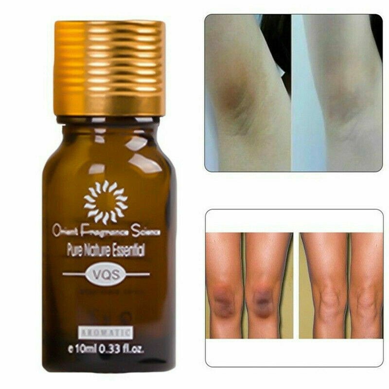 Ultra Brightening Spotless Oil Dark Spot Removal Natural Pure Oil Skin