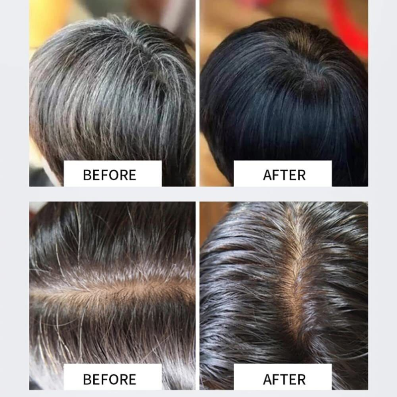 Hair Darkening Shampoo Bar Soap Grey Hair Reverse Organic Essence Conditioner US
