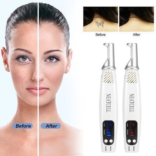 Picosecond Laser Pen Handheld Augenbrauen Tattoo Maulwurf Acne Entfernung Stift