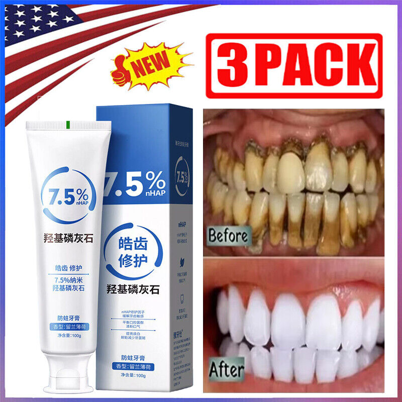 3X 7.5% Hydroxyapatite Toothpaste Remove Yellow Tooth Stains For Sensitive