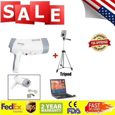 Carejoy Portable Electronic Colposcopy Colposcope High Resolution Vaginal Camera