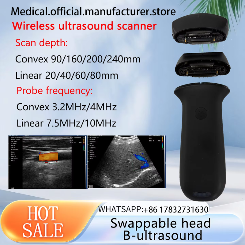 Swappable wireless probe color Doppler ultrasound linear and convex ...