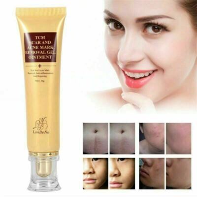 LanBeNa Pimple Scar Acne Mark Spots Removal Treatment Gel Ointment Blemish Cream