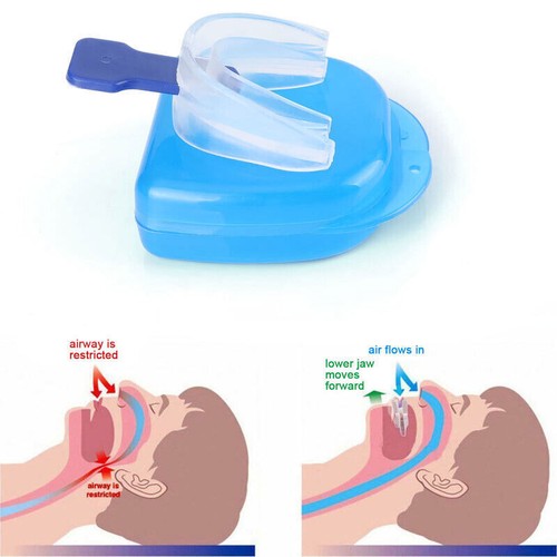 1PCS Anti Snore Stop Snoring Mouth Device Guard Good Sleep Aid No Apnea Silicon