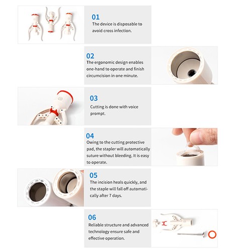 Disposable Foreskin Stapler Circumcision Safety Manual Stapler Device 13mm-34mm