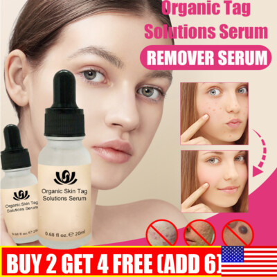 12Hours Wart Remover Pen Skin Tag Mole Remover Eliminate Foot Corn Warts Unisex
