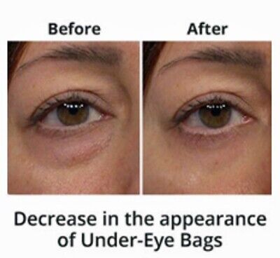 Under Eye Cream Remove Dark Circles Bags Face Lines Ageless Wrinkles Best