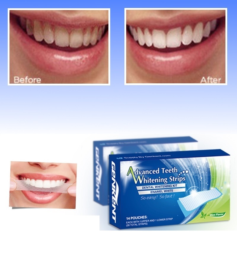 Bright White Smile Teeth Whitening Kit 3d Whitening Strips 2 Whitening Pens Ebay