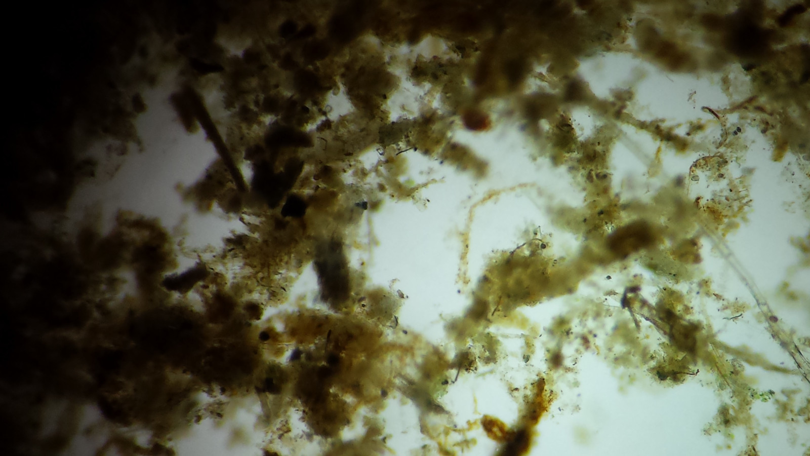 Microscope 32mm Rheinberg Filters Set With Darkfield Lighting - Marvelous Set!!!