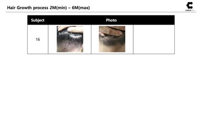 CARONBIO - C3 Hair Tonic