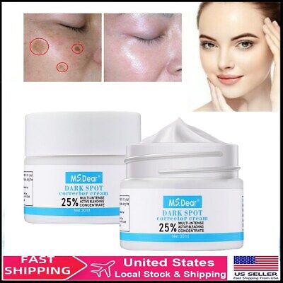 2X Freckle Whitening Face Cream Remove Melasma Pigment Melanin Scars Dark Spots