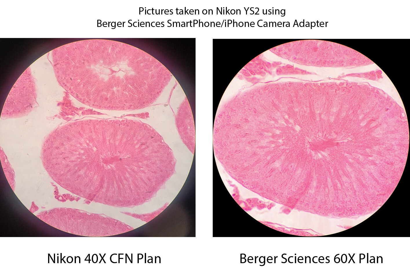 Sturdy Microscope Eyepiece Camera Adapter for Smartphone & iPhone