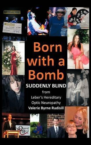 Valerie Byrne R Born With A Bomb Suddenly Blind From Leber's