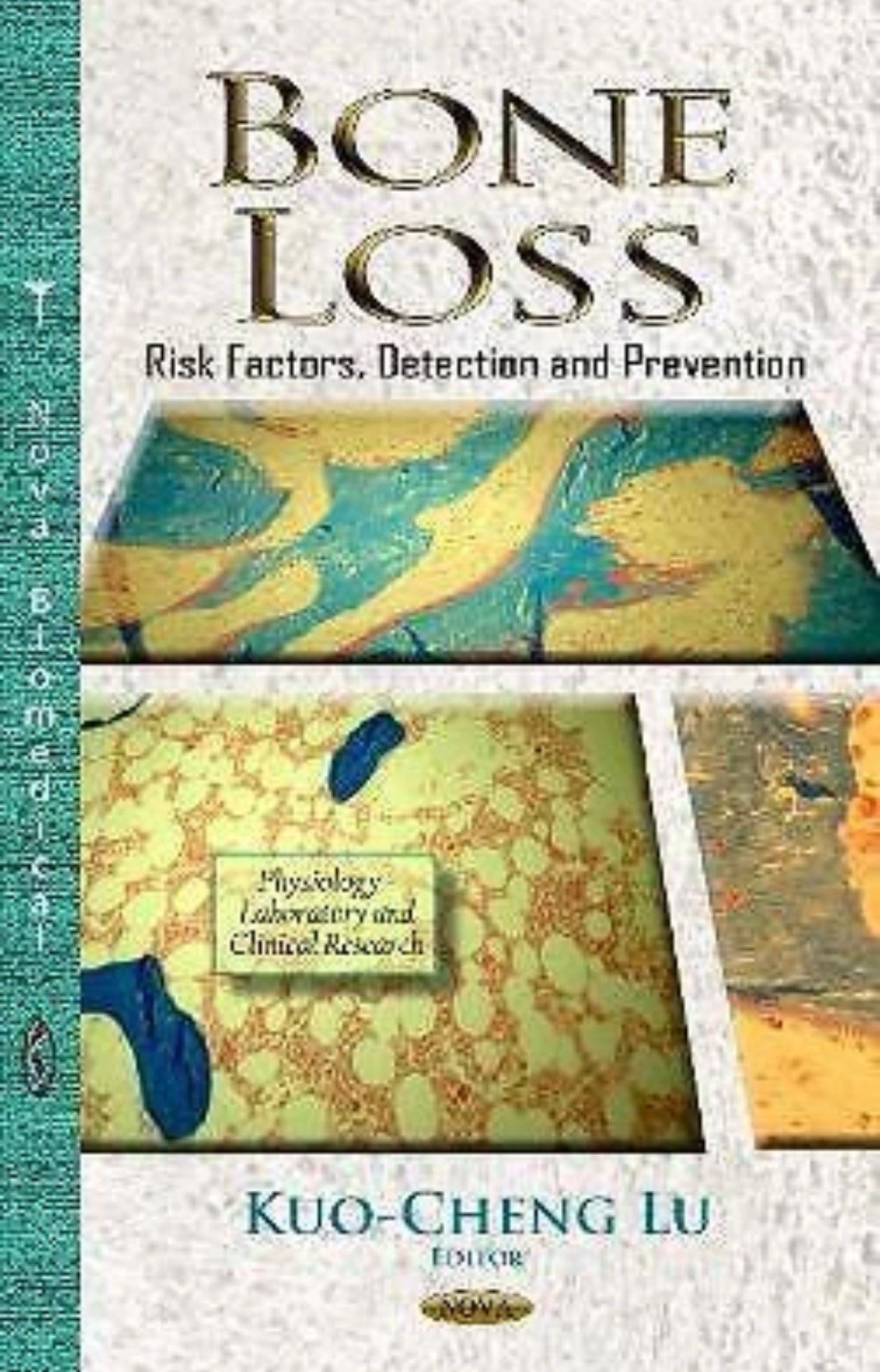 Bone Loss: Risk Factors, Physiology - Laboratory and Clinical Research