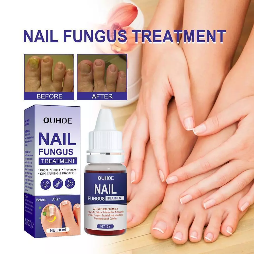 Anti fungal nail treatment online