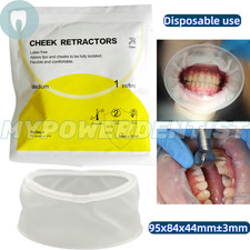 Dental Mouth Opener O Shape Lip Cheek Retractors Intraoral Lip Expander Opener