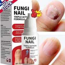 Fungi-Nail Anti-Fungal Liquid Solution Kills Fungus That Can Lead To Nail