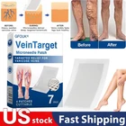 4-20 Pcs Vein Target Microneedle Patch Advanced Legs Varicose Veins Treatment