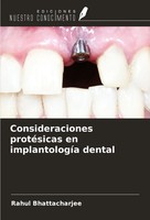 Consideraciones ProtéSicas En ImplantologíA Dental Rahul Bhattacharjee Buch 2024