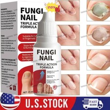 Fungi-Nail Anti-Fungal Liquid Solution Kills Fungus That Can Lead To Nail