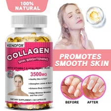 Collagen, Hyaluronic Acid & Vitamin C AntiAging Wrinkle Skin Capsules 3500mg