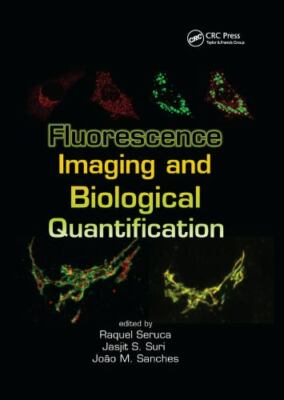 Fluorescence Imaging and Biological Quantification, Paperback by Seruca, Raqu...