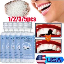 5/3x Tooth Repair Granules Temporary Reusable Moldable False Teeth Fitting Beads