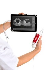 VITACON LAMINA MMT PORTABLE PATIENT 3D ULTRASOUND USB IMAGE SCAN BLADDER SCANNER