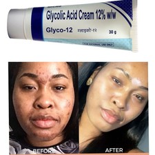 Glyco 12 Glycolic Acid 12 Cream 30g Facial Skin Care