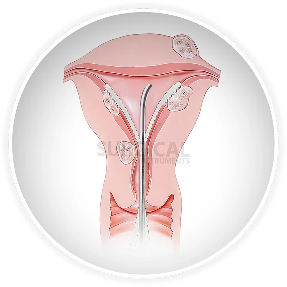 2 Pcs of Sim Uterine Sounds Straight & Curved Gynecology Surgical German Grade - Image 4 of 4