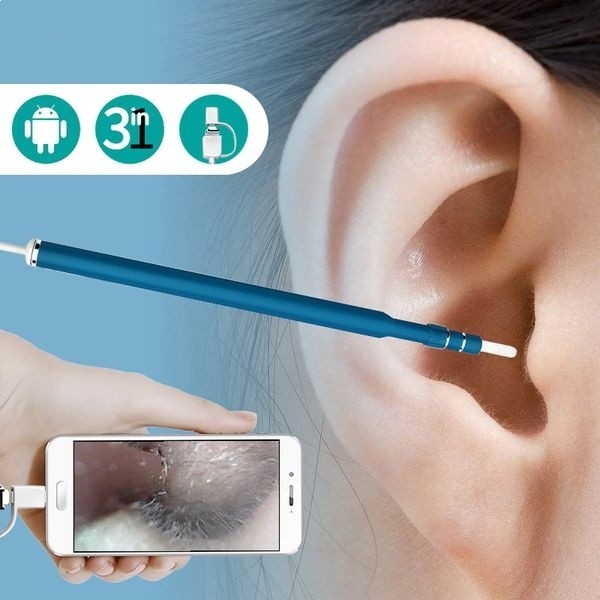 Endoscope oreille HD 720P pour retirer le cérumen en toute sécurité à la maison