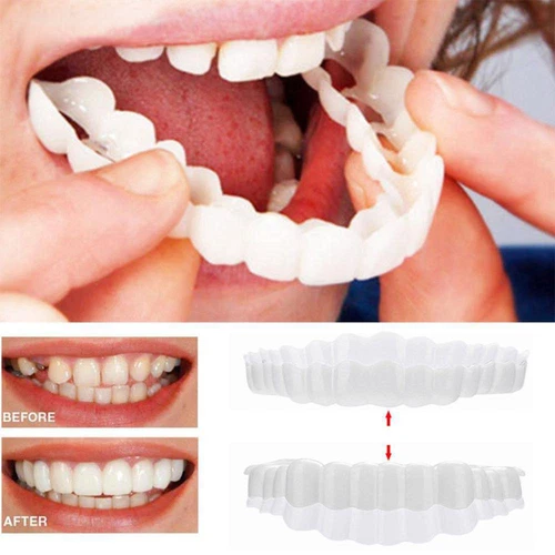 Snap On Upper&Bottom Set False Teeth Dental Veneers Denture Tooth Cover Silicone - Bild 1 von 14