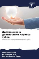 Sibil Siluwaj (U. A.) | Dostizheniq W Diagnostike Kariesa Zubow | Taschenbuch