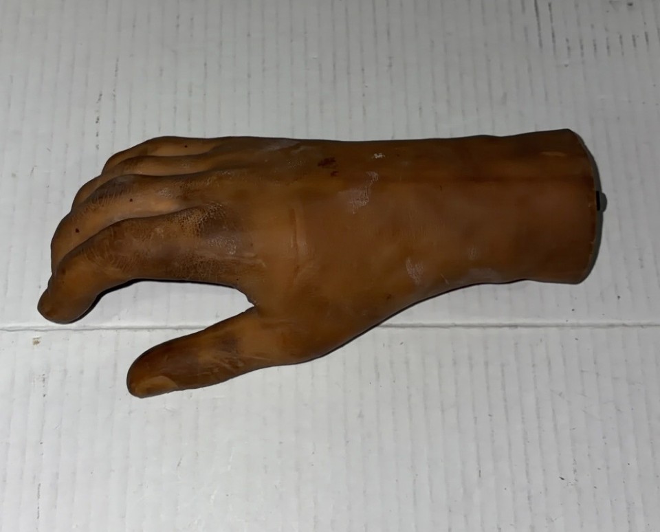 A vintage rubber prosthetic hand in dark tone — a genuinely unsettling and fascinating piece of mid-20th century medical history.