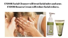 Rosacea and Facial Acne - Facial wash and Cream deal .