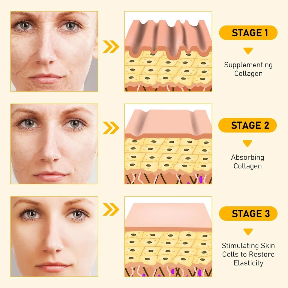 Crema hidratante reafirmante natural para todo tipo de piel de veneno de abeja 2 piezas Foto 4 de 4