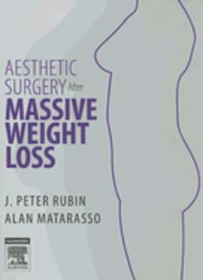Aesthetic Surgery After Massive Weight Loss by Facs Matarasso, Alan, MD: New