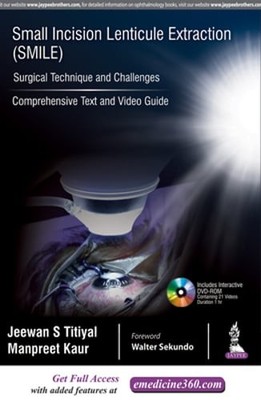 Small Incision Lenticule Extraction (SMILE): Surgical Technique and Challenges:
