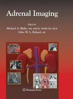 Giles Boland (U. A.) | Adrenal Imaging | Taschenbuch | Englisch (2014) | X