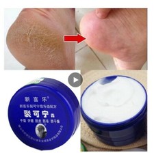 j CREAM TREATMENT HANDS FEET CRACKED DRY SKIN HEELS CHINESE MEDICINE