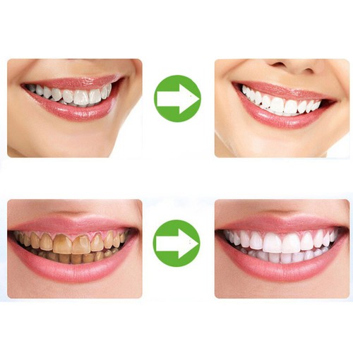 2 szt. Tace do wybielania zębów Wieloformowalne osłony gum dentystycznych Łatwa szybka forma - Zdjęcie 6 z 19