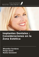 Implantes Dentales : Consideraciones En La Zona EstéTica Bhumika Sardana (U. A.)