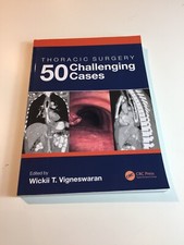 Thoracic Surgery 50 Challenging Cases